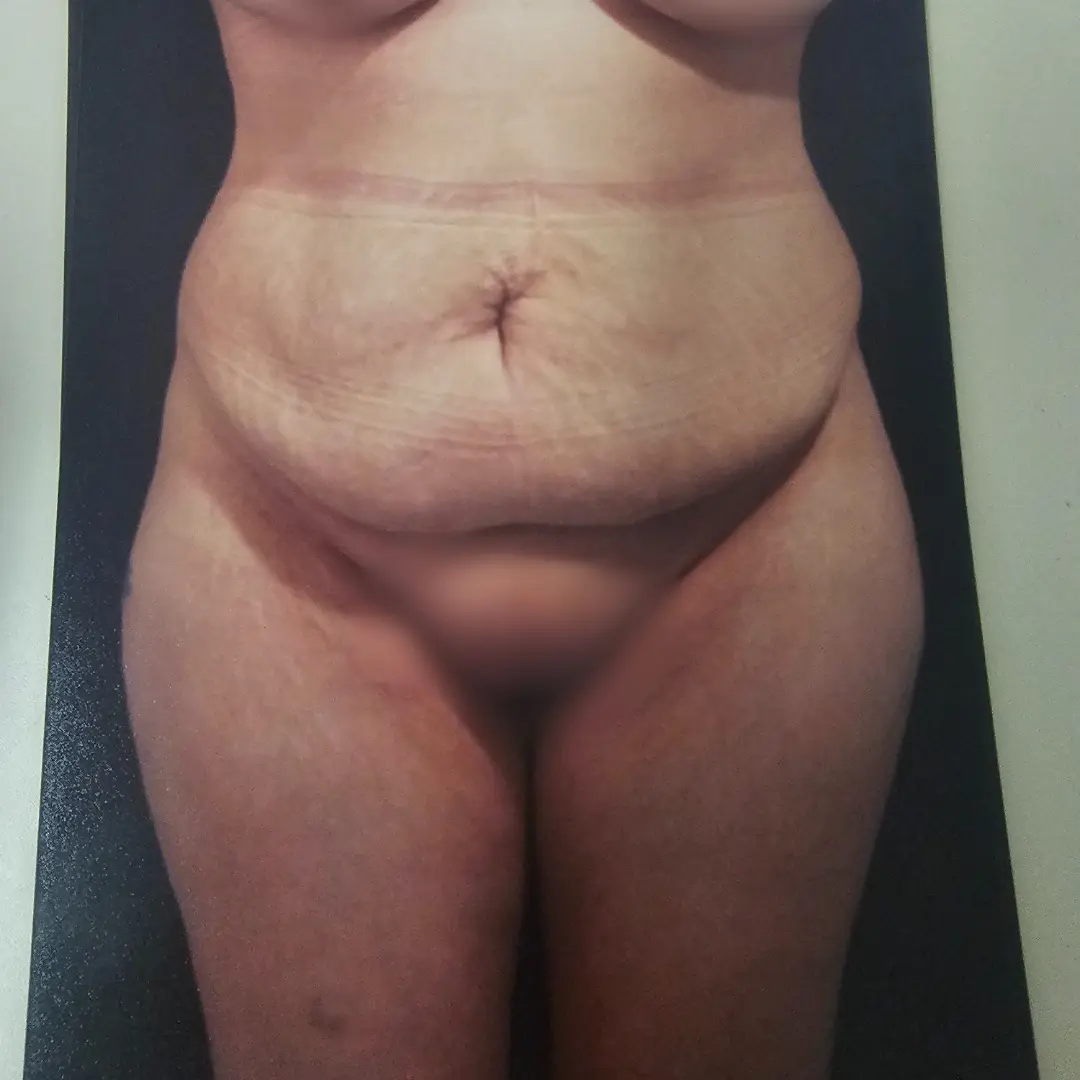 Galería: Dra Cirugía 127 Antes 12