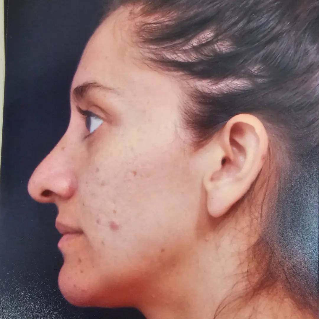 Galería: Dra Cirugía 197 Antes 13