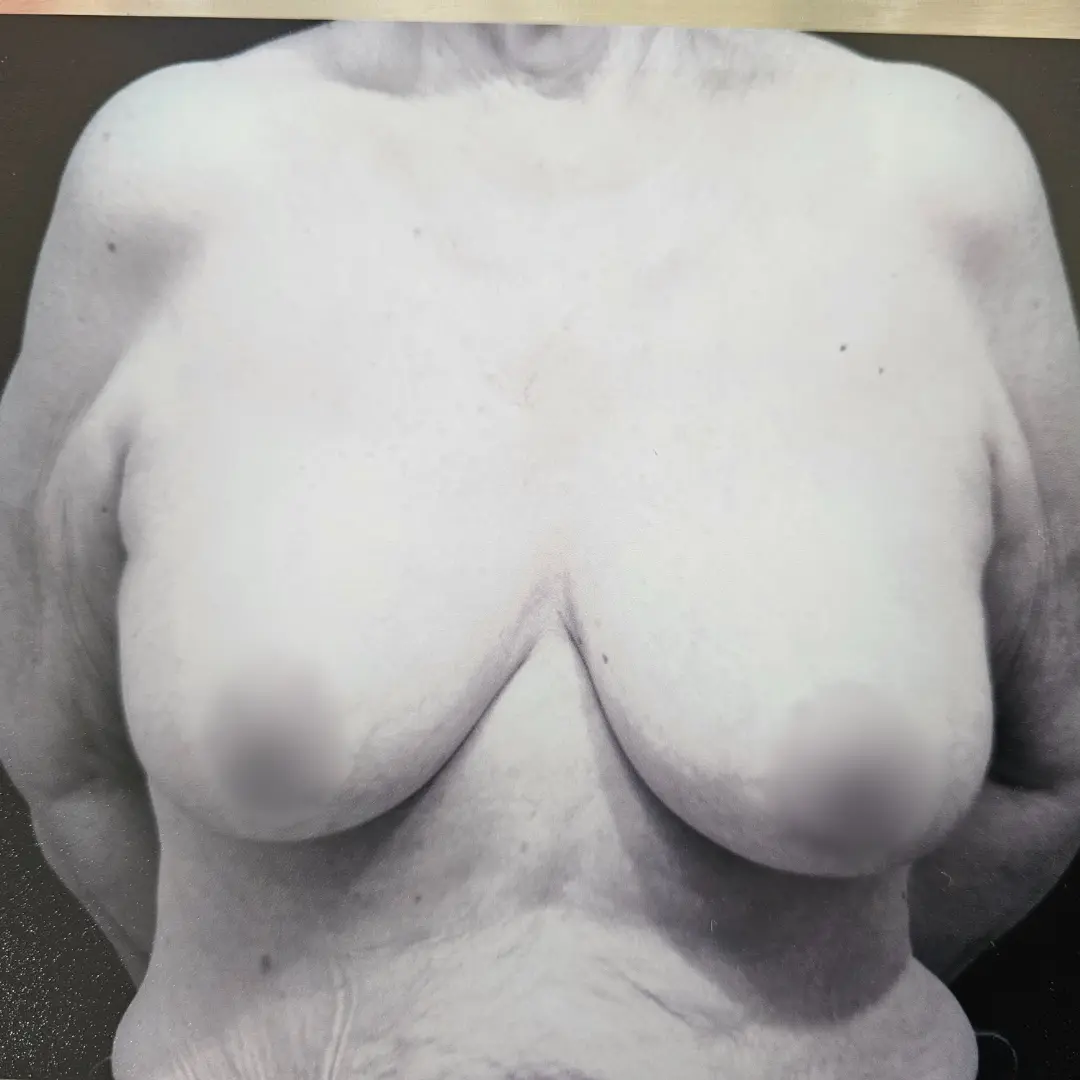Galería: Dra Cirugía 161 Antes 18