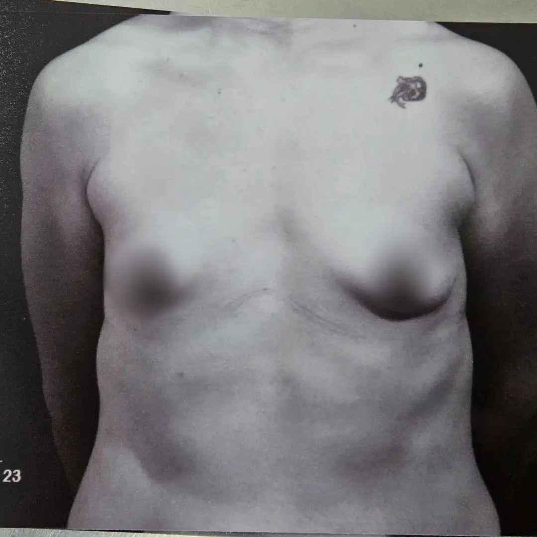 Galería: Dra Cirugía 169 Antes 20