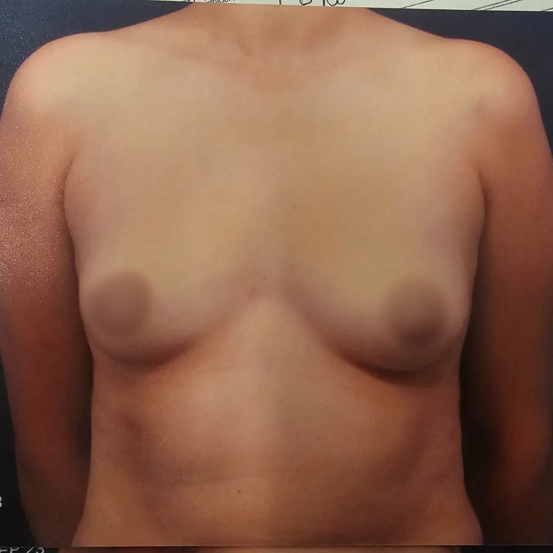 Galería: Dra Cirugía 141 Antes 24