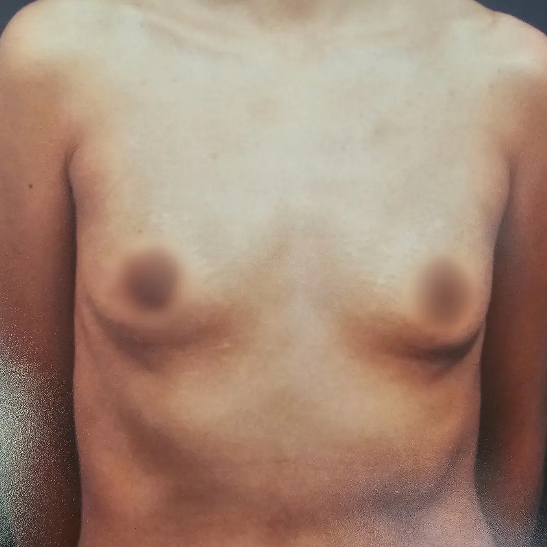 Galería: Dra Cirugía 171 Antes 25