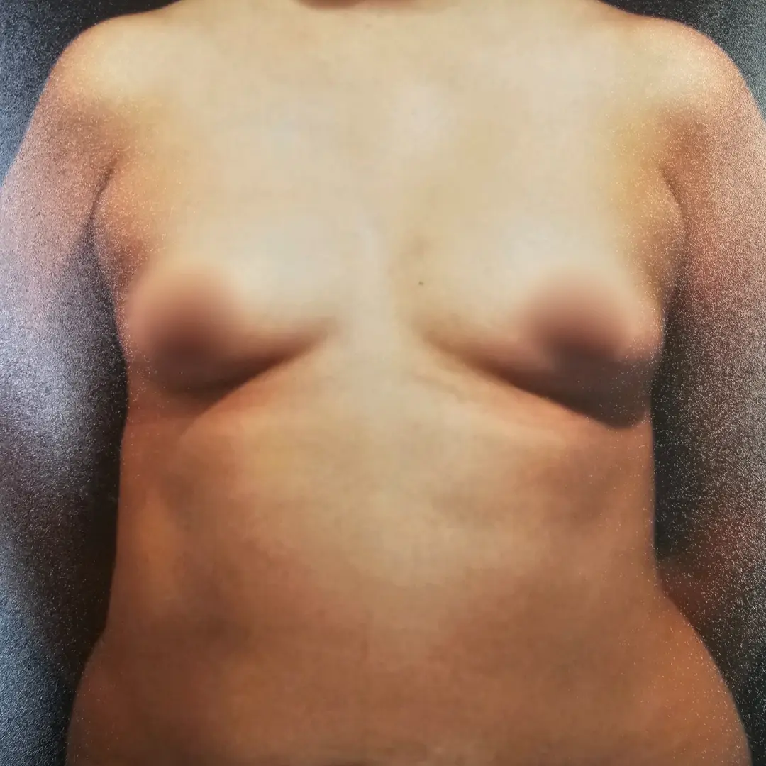 Galería: Dra Cirugía 147 Antes 3