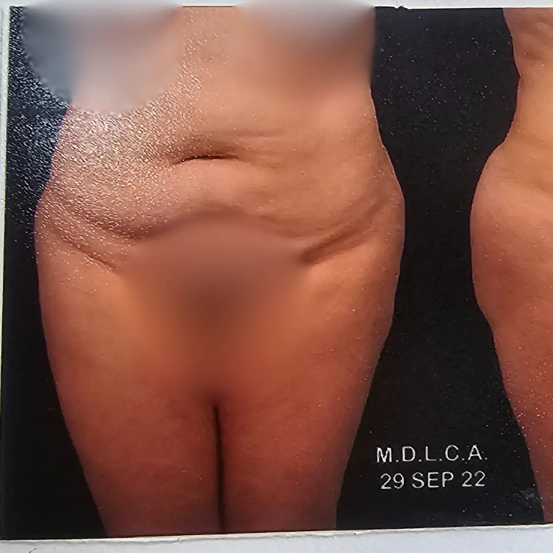 Galería: Dra Cirugía 117 Antes 5